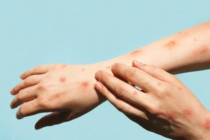 Marina Demidiuk/ Getty Images